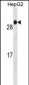 GSTA1 Antibody