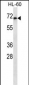 HIPK4 Antibody (ascites)