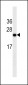 Glucagon Antibody (ascites)