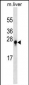 S100B Antibody