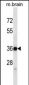 SYP Antibody (C-term) (ascites)