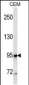 MME/CD10 Antibody (ascites)