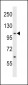 ACK1 Antibody (Center Y284)