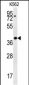 DGCR14 Antibody (Center)