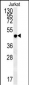 DAO Antibody (Center)