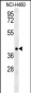 TRAF1 Antibody (N-term)