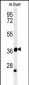 TRAF1 Antibody (N-term)