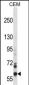 NOX5 Antibody (C-term)