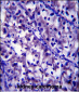 LAMB1 Antibody (C-term)