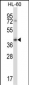 FCGR2B Antibody (C-term)