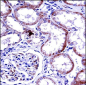 HTRA3 Antibody (Center)