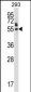 HEXIM1 Antibody (N-term)