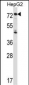 IL1R1 Antibody (C-term)