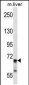 IL1R1 Antibody (C-term)