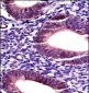 MMP17 Antibody (C-term)