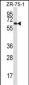 MMP17 Antibody (C-term)