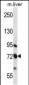 MMP17 Antibody (C-term)