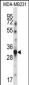 TNFSF13B Antibody (N-term)