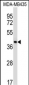 SFTPD Antibody (C-term)