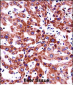 ITGB5 Antibody (N-term)