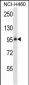 ITGB5 Antibody (N-term)