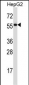 PDIA2 Antibody (Center)