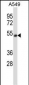 CHRNA5 Antibody (Center)