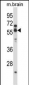 CHRNA5 Antibody (Center)