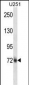 HNRNPM Antibody (N-term)