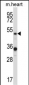 PIAS4 Antibody (N-term)