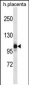 NLRP12 Antibody (N-term)