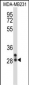 NEUROG2 Antibody (Center)