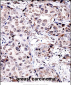 SIRT6 Antibody (C-term)