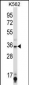 SIRT6 Antibody (C-term)