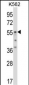 ODC1 Antibody (C-term)