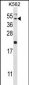 HAVCR1 Antibody (N-term)