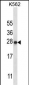 IL22 Antibody (Center)