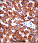 CYB5A Antibody (Center)
