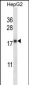 CYB5A Antibody (Center)