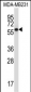 PPP2R5C Antibody (C-term)