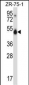 CUGBP1 Antibody (N-term)