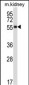 SSTR1 Antibody (C-term)