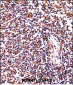 HCLS1 Antibody (C-term)