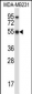 HCLS1 Antibody (C-term)