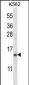 TNFRSF13C Antibody (N-term)