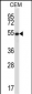 GABPA Antibody (Center)