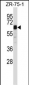 STAM2 Antibody (Center)