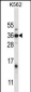 DLX4 Antibody (Center)