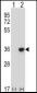 DLX4 Antibody (Center)