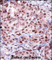 TERF2IP Antibody (C-term)